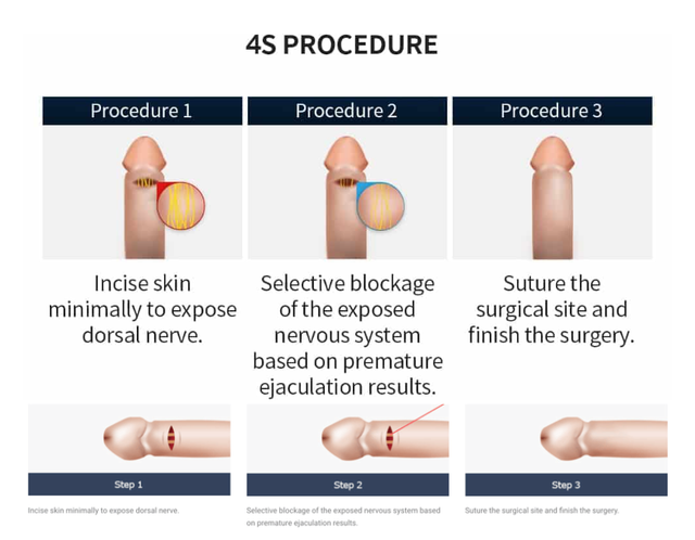 1 Penis Enlargement Surgery in Korea Seoul Proud Urology Clinic